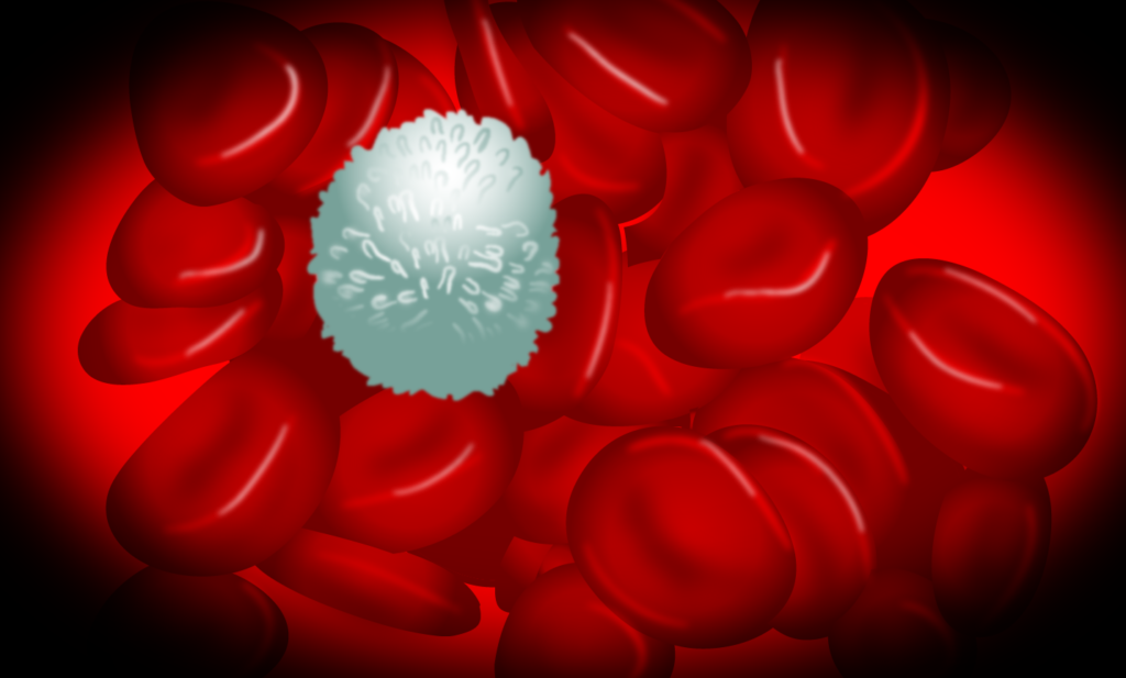 Рак крови - гематобластох