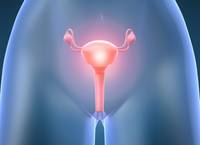 Рак женских половых органов